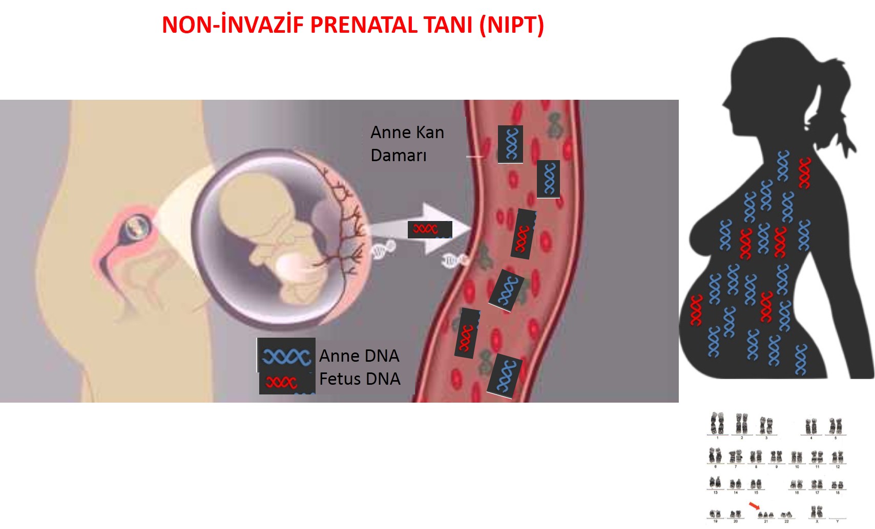 NON INVASIVE PRENATAL TEST (NIPT)